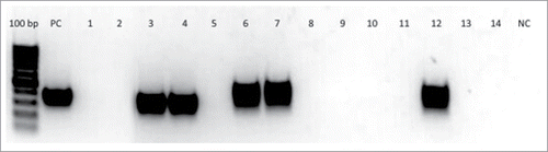 Figure 3. Results of double-nested PCR for identification of DNA of bacteriophage PA5 in the blood of 10 patients and 2 healthy volunteers. Gel electrophoresis lines of the 3rd round PCR products (amplicons): 100 bp – DNA ladder, PC – positive control (DNA of Pseudomonas aeruginosa PA5 phage), 1–2 - blood samples from healthy volunteers before PA5 phage administration, 3–4 – blood samples from healthy volunteers on 3rd day of PA5 phage administration, 5–14 – blood samples from 10 patients 24 h after end of intragastric administration of a bacteriophage cocktail including PA5 phage, NC – negative control (reaction mix). In the samples of 2 healthy volunteers (lines 3 and 4) and 3 patients (lines 6, 7, 12) bends corresponding to DNA of phage PA5 were found.