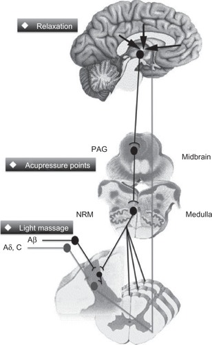 Figure 1 The different levels of pain modulation mechanisms used by the Bonapace Method.