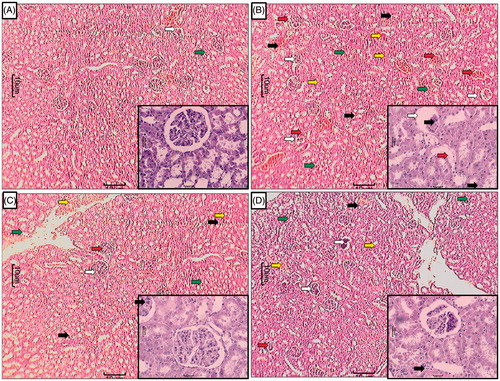 Figure 4. Effect of treatment of APME on paracetamol-induced pathological alteration in rat kidney. Photomicrograph of sections of kidney of normal (A), APAP (B), silymarin (25 mg/kg) treated (C), and APME (400 mg/kg) treated (D) rats. Glomerular hypertrophy (white arrow), inflammatory infiltration (black arrow), edema (yellow arrow), congestion (green arrow), and necrosis (red arrow). H&E staining at 40 × and 100 × (inset).