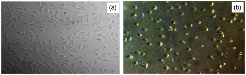 Figure 5. Microscope fluorescence images of (a) original cell lines MCF-7 before any treatment by nanoproducts, and (b) after treatment with influence of ZnO (a) and ZnO (c) nanodrugs caused significant morphological changes which are signs of cell death (the kind of deformation and agglomeration of MCF-7 cancer cell models).