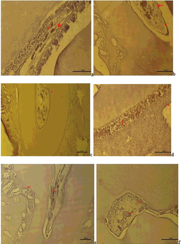 Figure 3. a– Group I: VEGF positive expression observed in dlated vessels and inflammatory cell infiltrations in the pulp (VEGF immune staining 100 µm); b – Group II: VEGF positive reaction in the vessel wall in the pulp (red arrow), reduced and weak VEGF expression in inflammatory cells (VEGF immune staining 100 µm); c – Group III: VEGF positive expression in the vessels close to odontoblastic cells and in vessels in the cement-periodontal space (red arrow) and neo-angiogenesis was seen to have been induced (VEGF immune staining 100 µm); d – Group V: VEGF positive expression in the endothelial cells of the expanded vessel wall in the pulp, in the small vessels between degenerative odontoblast cells and in inflammatory cells (VEGF immune staining 50 µm); e – Group VI: VEGF positive expression in the vessels of the periodontal ligaments and pulp (VEGF immune staining 100 µm), f – Group VII: VEGF positive reaction in the small blood vessels of the pulp and in some inflammatory cells (VEGF immune staining 50 µm).