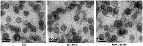 Figure 1. Morphological analysis of exosomes by EM. Exosomes from MCF-7 cells without doxorubicin treatment, or doxorubicin-treated MCF-7 cells with or without heat-stress treatment were purified by serial centrifugation and sucrose gradient ultra-centrifugation. The morphology of exosomes was visualised under EM. Bars = 100 nm. Data were representative images of individual exosome samples from three independent experiments.
