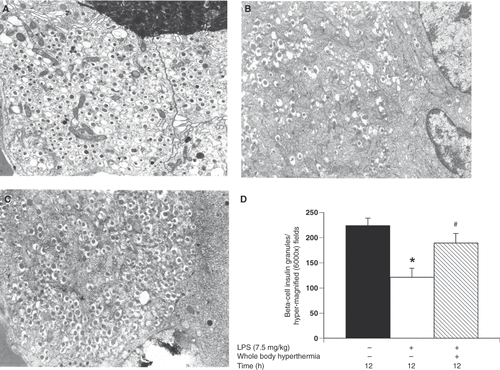 Figure 2. Evaluation of the effects of whole-body hyperthermia on pancreatic tissue in LPS-treated rats by electron microscopy. (A–C) High magnification of beta cell insulin granules. Pancreatic tissue specimens were obtained from the negative control group (A); untreated, LPS group (B); and WBH-treated, LPS group (C). (D) Sections from rats who were administered LPS for 12 h with or without WBH pretreatment. Sections from the three groups were blindly chosen and the number of insulin granules was counted in hyper-magnified fields. All data are expressed as the mean ± SD. # denotes a significant difference compared to the LPS group (p < 0.05); * denotes a significant difference compared to the negative control group (p < 0.05).