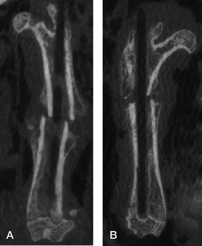 Figure 1. Coronal micro-CT scan at 6 weeks. A. Low rigidity group (Ti-24Nb-4Zr-7.9Sn). B. High rigidity group (Ti-6Al-4V). The intramedullary devices have been removed for reduction of metal artifact.