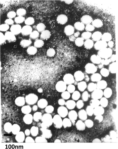Figure 2. Transmission electron microscope images of PTX-loaded stealth liposomes.