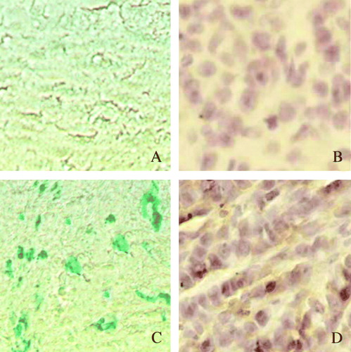 Figure 3.  The transfection efficacy of intratumoral injection of the adenovirus. The cells that were successfully transfected by intratumoral injection of Adv-LacZ (C) or Adv-SSTR2 (D) in capan-2 xenografts were shown by β-galactosidase staining and histrochemistry, respectively. The results were observed under light microscope (x 400). A: untransfected conrol of capan-2 xenograft, stained for β-galactosidase; B: untransfected control of capan-2 xenograft stained with anti-SSTR2 and HRP-conjugated secondary antibody; C: capan-2 xenograft transfected with Adv-LacZ, stained for β-galactosidase; D: capan-2 xenograft transfected with Adv-SSTR2 was stained with anti-SSTR2 and HRP-conjugated secondary antibody.