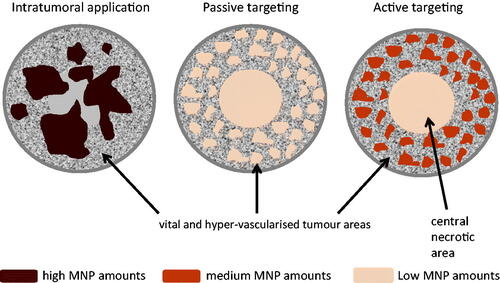 Figure 2. Intratumoral nanoparticle distribution patterns according to dependence upon different application routes. Intratumoral application: heterogeneous distribution as a result of the high interstitial pressure of tumour tissue. Active and passive targeting leads prospectively to a comparatively homogeneous distribution around the vessels of the vital tumour area. Nanoparticle retention during passive targeting is due to the lack of lymphatic drainage in tumours. Active targeting prospectively leads to increased retention compared to passive targeting on the basis of augmented internalisation into cells after specific ligand binding. There are ongoing discussions that only 1 to 10 % of the intravenously injected dose are will end up in the tumour region [Citation56] as well as on how active targeting favours nanoparticle accumulation in tumours. MNP, magnetic nanoparticles.