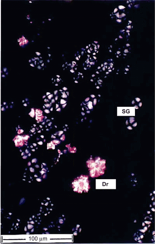 Figure 3.  Powder microscopy of the root under polarized light. Dr, druses, SG, starch grains.