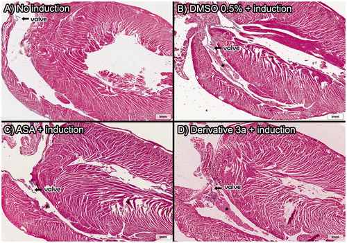 Figure 6. Heart histopathology after in vivo pulmonary thromboembolism model assays induced by thrombin. Thrombi located in the right ventricle reveal the migration of microemboli under formation to the lungs of the animal subjects. Only derivative 3a was used because the high survival rate was observed previously. All derivatives and ASA were assayed at 10 mM/kg (HnE staining, 8× magnification; scale bar = 600 μm) (A) Control group and *=thrombi.