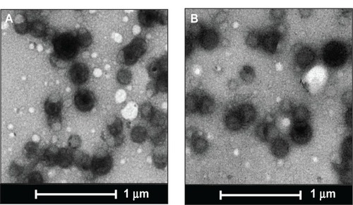 Figure 1 Transmission electron micrographs of PLGA nanoparticles.Notes: The transmission electron microscopic images of (A) unloaded and (B) miR-150-loaded nanoparticles. Scale bar is 1 μm.Abbreviation: PLGA, poly (D,L-lactide-co-glycolide).