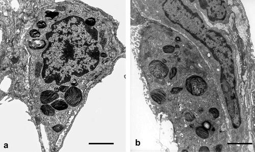 Figure 4. Type II alveolar epithelial cells (AEII). (a) Control lung: AEII, structurally intact, with intact organelles. Lb appear normal in number and size. Scale bar = 2µm. (b) OVA sensitized and challenged lung: structurally intact AEII. Distribution and size of Lb profiles are qualitatively comparable with controls. No giant or very small Lb profiles or unnatural accumulation as signs of disturbances of intracellular surfactant synthesis are seen. Scale bar = 2 µm.