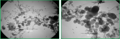 Figure 5 TEM micrographs of green synthesized CeO2 NPs.Abbreviations: NPs, nanoparticles; TEM, transmission electron microscopy.