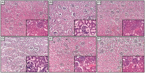 Figure 2. Effect of naringin on sodium arsenite-induced alteration in kidney histology of rats. Photomicrograph of sections of kidney from normal group (A); Arsenic Control group (B); Coenzyme Q10 (10 mg/kg, p.o.) treated group (C); Naringin (20 mg/kg, p.o.) treated group (D); Naringin (40 mg/kg, p.o.) treated group (E) and Naringin (80 mg/kg, p.o.) treated group (F). H & E staining at 100× and respective inset at 400×.