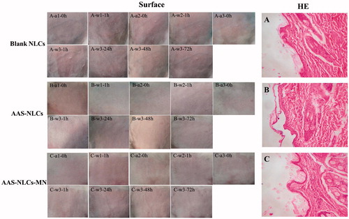 Figure 7. Irritation responses on the surface and microstructure of the rabbit back skin. The skin was treated with (A) blank NLCs; (B) AAS–NLCs; (C) combination of AAS–NLCs and MNs; (a) with drugs applied; (w) with drugs washed off. Magnification: 100×.
