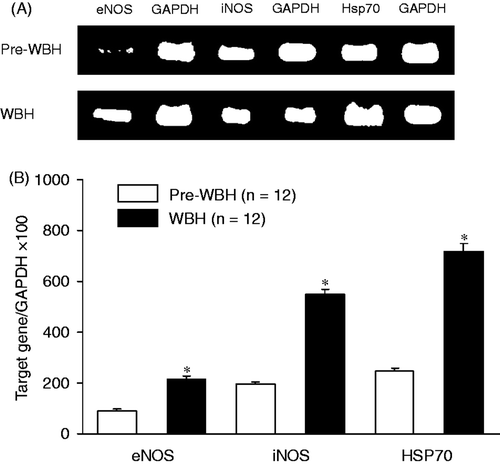 Figure 1. A real-time PCR 2.8 ± 0.4, 3.1 ± 0.5 and 3.2 ± 0.8 analysis of eNOS, iNOS and Hsp70 expressions of the liver tissues from the pre-WBH and WBH groups (A). The increases in eNOS, iNOS and Hsp70 mRNA were 2.8 ± 0.4, 3.1 ± 0.5 and 3.2 ± 0.8-fold, respectively (B). There were 12 rats in each group, *p < 0.05, pre-WBH versus WBH. Pre-WBH and WBH denote before and 15 h after whole body hyperthermia. Glyceraldehyde phosphate dehydrogenase (GAPDH) serves as contrast.