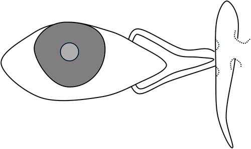 Figure 2. BR Jones’ Canaliculodacryocystorhinostomy.