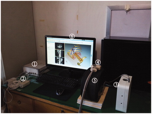 Figure 1. Physical set up and components of 3D visualisation preoperative treatment planning system. (1) A control unit of the electromagnetic tracking system, (2) two sensor interface devices of the electromagnetic tracking system, (3) a field generator of the electromagnetic tracking system, (4) tracked ultrasound probe, (5) a simulation model, (6) screen.