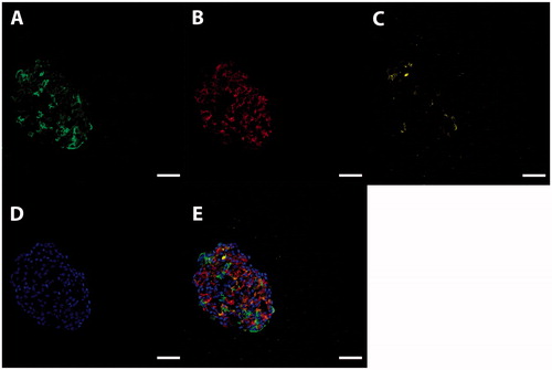 Figure 1. Characterization of human stem cell-derived ICC. Representative images of a sectioned islet-like cell cluster (stage 7) stained for insulin (A, green), glucagon (B, red), and somatostatin (C, yellow). Hoechst-staining is shown in blue (D). Overlay image of images A–D is shown in E. Scale bar, 50 µm.