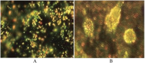 Figure 16. (A) Dispersion of gold nanoparticle in healthy cells, (B) With a cancer cell concentrated gold nanoparticles.