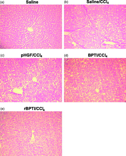 Figure 5. rBPTI reduces carbon tetrachloride-induced liver damage in rats. Paraffin-embedded liver tissue sections were stained with H&E for light microscopic assessment of liver damage (200 × magnification). Images shown are representative of 10 rats in each group.