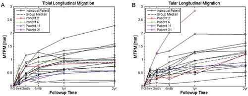 Figure 2. MTPM longitudinal migration of the spherical tip of the tibial component (A) and the talar component (B). Thin black lines: individual patients. Dashed line: group median. Red, green, blue, and magenta: patients who underwent surgical revision. The discontinuities and missed data points indicate where the patients missed follow-up examinations or where the results of the examinations were not usable.