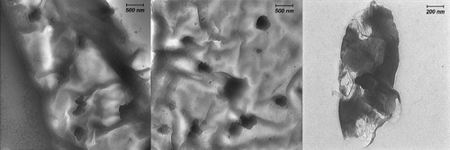 Figure 4. Low-magnification TEM images of a sample consisting of gold nanoparticles on R. solanacerum bacteria surface.