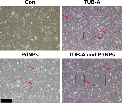 Figure 5 Effects of TUB-A or PdNPs alone or in combination on cell morphology of MDA-MB-231 human breast cancer cells.Notes: Human breast cancer cells were incubated with TUB-A (4 μM) or PdNPs (4 μM) or a combination of both (at 4 μM each) for 24 h. Red arrows indicate that the detachment of cells from the surface. The treated cells were photographed under a light microscope (200 μm).Abbreviations: Con, control; TUB-A, tubastatin-A; PdNPs, palladium nanoparticles.