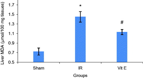 Figure 2. Liver MDA (mean ± SEM): Note: *Denotes p < 0.05 versus sham group and # denotes p < 0.05 versus IR group.