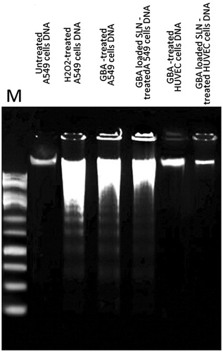 Figure 8. DNA ladder formation through gel electrophoresis in different treatments, and A549 cells and HUVEC. M, molecular marker.