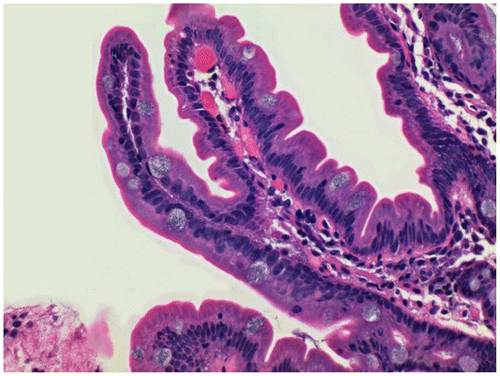 Figure 2 Duodenal biopsy stained with Gill’s B hematoxylin and eosin–phloxine, ×40. Mucin is stained blue.