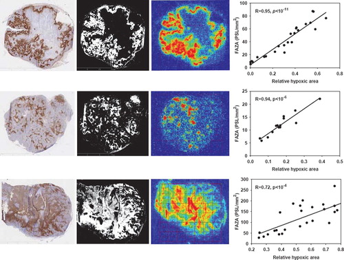 Figure 1. Late time PET hypoxia scans in tumor-bearing mice provides a quantitatively accurate measure of the density of hypoxic cells. Left column: pimonidazole stained tumor section, second column: segmented pimonidazole image showing the distribution of pimonidazole-positive cells (pO2 < ∼10 mmHg). Third column: FAZA autoradiogram obtained from the same tissue section. Last column: scatterplot showing the spatial relationship between average FAZA signal and relative area covered by hypoxic cells derived by a pixel-by-pixel (2×2 mm) comparison between the segmented pimonidazole image and the FAZA autoradiogram. Upper row: UT-SCC-33, middle row: SiHa, lower row: SCCVII.