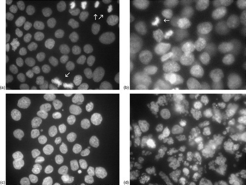 Figure 3. (A) and (B): Representative examples of the morphological evaluation following DAPI preparation of the cells are shown. In (A), treatment with DOC (0.1 ng/ml) only is shown. The arrow indicates a mitotic cell; mitoses were abundant at this DOC concentration. Following single treatment with ZOL (50 µM), mitotic cells were also frequent (the arrow indicate such an example). The combined treatment (C) reduced the number of mitotic cells, an observation in accordance with decreased proliferation. Apoptotic cells, as seen in the positive control (DOC 10 ng/ml) (D), were, though, still rare (apoptotic cells indicated by arrows).