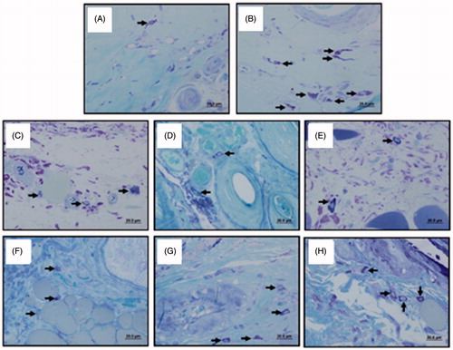 Figure 8. Images of infiltrated mast cells from tissue sections. (A) healthy control, (B) atopy control, (C) BMV-loaded commercial cream, (D) BMV-loaded liposome in gel, (E) BMV-loaded nanoparticle in gel, (F) DFV-loaded commercial cream, (G) DFV-loaded liposome in gel, (H) DFV-loaded nanoparticle in gel.