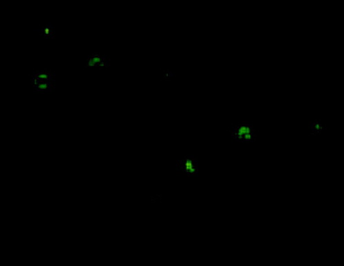Image1.  The TERTt expression can be detected in Dendritic cells by using immunofluorescence assay 24 hours post TERTt mRNA electroporation. (First antibody: rabbit anti mouse TERT; Second antibody: FITC-goat anti rabbit IgG)