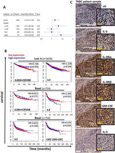 Figure 1. IL-3, IL-3R, IL-5 and GM-CSF expression by human breast cancer subtypes.(A) Swimmer plots representing gene expression of IL3+IL3RA+CSF2RB combined in breast cancer patients as a whole or separated into the molecular subtypes (luminal A, luminal B, HER2 enriched or basal-like) with number of patients, hazard ratio (HR) and the log-rank p value calculated by Cox-regression analysis; p < 0.05 considered significant. (B) Kaplan-Meier plots of the luminal A (Lum A, n = 1678), or basal-like subtype (n = 714) of breast cancer patients for gene expression of either IL3RA+CSF2RB, IL3, IL5 or CSF2 with high (blue) versus low (red) based on median expression levels, with HR and log-rank p value calculated by Cox-regression analysis; p < 0.05 considered significant. (C) Representative IHC analysis of IgG1 isotype control or antibodies targeting IL-3, IL-3Rα, IL-3Rβ, GM-CSF or IL-5 protein expression by human TNBC tumor tissue. DAB staining (brown) and hematoxylin counterstain (blue). White scale bar = 100µm. Yellow scale bar = 50µm.