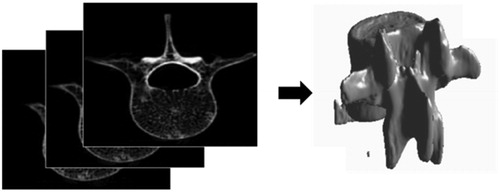 Figure 3. CT images were loaded into MATLAB to generate the bone geometry for simulation.
