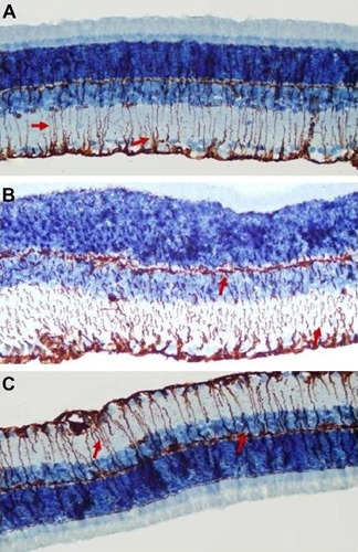 Figure 5 Micrographs of retinal vimentin staining for one rat in each treatment group.