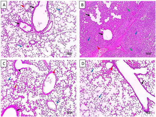 Figure 3. Histological features of the lung tissues stained with H&E of A) Group I with normal-sized alveoli separated by fibrous septa (blue arrows), normal-sized bronchioles (black arrows), and normal-sized blood vessels (red arrow) (×100). B) Group II with dilated destructed bronchioles (black arrows), surrounded by marked alveolar fibrosis (blue arrows), marked inflammation (green arrows), and vascular congestion (red arrow) (×100). C) Group III with normal-sized bronchioles (black arrows), surrounded by normal-sized alveoli (blue arrows) with focal alveolar and vascular congestion (red arrows) (×100). D) Group IV with dilated bronchiole (black arrow), surrounded by normal-sized alveoli (blue arrows) with focal alveolar congestion (red arrow) (×100).