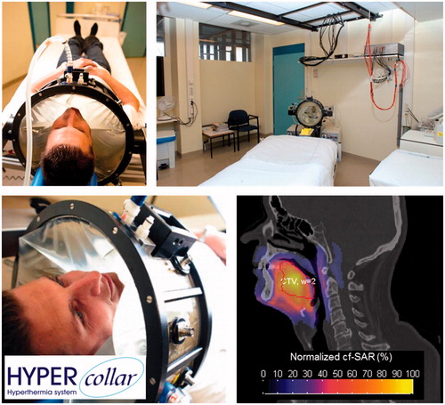 Figure 1. Different views of the HYPERcollar, the clinical setup and an example simulated SAR pattern on top of a CT scan.