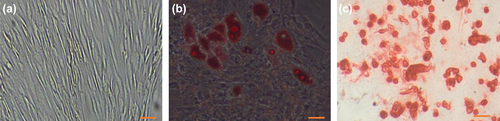 Figure 2. Differentiation potential of AT-MSC. Passage 3 of isolated AT-MSCs (a) Microscopic image views of the differentiation of AT-MSCs into adipogenic (b), osteogenic (c) lineages. Oil red staining shows lipid droplets stained red, deposits of calcium crystals stained red to brown by alizarin red staining (c). Bars, 50 &mu;m.