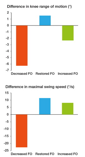Figure 2. Difference in knee range of motion and maximal swing speed between the operated side and the healthy limb. In contrast to the 2 other groups, in the “decreased” group there was a statistically significant decrease in the knee range of motion and the maximal swing speed during the gait cycle.