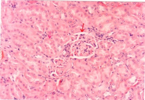 Figure 8 A photomicrograph of the renal cortex of a control rat. The red arrows showing parenchyma with normal glomeruli and tubules, ×200 magnification.