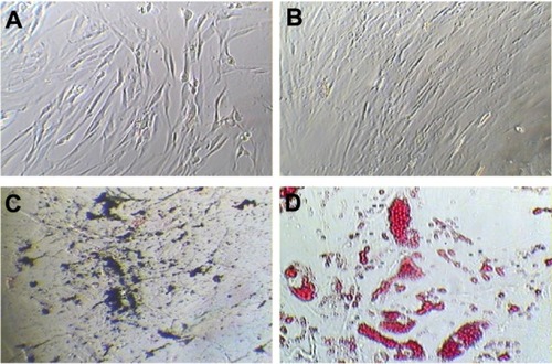 Figure 7 Characterization of hBMSCs at third passage. (A) Morphology of cells on day 7 of culture. (B) Morphology of hBMSCs on day 14, showing 80% confluency. (C) von Kossa staining for calcium deposits shown as black-colored crystals after osteogenic differentiation and (D) Oil O Red stains of lipids after adipogenic differentiation.Note: All images were obtained under light microscopy at 100× magnification.Abbreviation: hBMSCs, human bone marrow-derived mesenchymal stem cells.