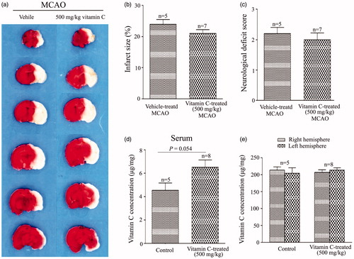 Figure 4. A single high dose vitamin C has no effect on MCAO. (a) Representative images of brain slices obtained at 24 hr post-MCAO from rats treated with vehicle or treated with a single high dose vitamin C (500 mg.kg−1) 24 hr before MCAO. (b,c) Bar graphs showing the relative infract size (b) and neurological deficit score (c) for a single high dose vitamin C-treated (500 mg.kg−1) vs vehicle-treated MCAO rats. (d,e) Vitamin C concentration in the serum (d) or brain tissue (e) of rats after 24 hr treament with vehicle or a single high dose vitamin C (500 mg.kg−1).