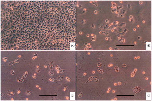 Figure 4. Observation of HeLa cells in different groups by optical microscope. (A) control group; (B) free DOX group; (C) DOX/P(HB-HO) NPs group and (D) DOX/FA-PEG-P(HB-HO) NPs group. The black line represents a distance of 100 μm.