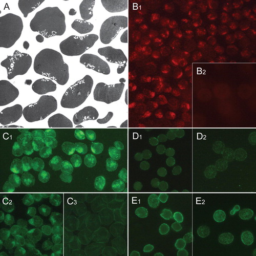 Figure 2.  Distribution of raft markers in human erythrocyte membrane invaginations. Transmission electron micrograph showing invaginated human erythrocytes following incubation with chlorpromazine (100 µM, 60 min, 37°C) (A). Clustered endovesicle-like invaginations are seen. Cholera toxin subunit B staining of gangliosides in erythrocytes treated with chlorpromazine (B1) and untreated cells (B2). Ganglioside GM1-BODIPY staining of erythrocytes treated with chlorpromazine (C1), Triton X-100 (C2) and untreated cells (C3). Immunocytochemical detection of flotillin-1 in erythrocytes treated with chlorpromazine (D1) and untreated cells (D2). Immunocytochemical detection of stomatin in erythrocytes treated with chlorpromazine (E1) and untreated cells (E2). Notably, the magnification is larger in A than in other micrographs. This Figure is reproduced in colour in Molecular Membrane Biology online.