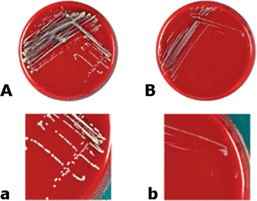 Figure 2. Sheep blood agar plates (panels A and B) and magnified sectors (panels C and D) after overnight incubation at 37°C, showing two morphotypes of clonal isolates of Staphylococcus lugdunensis recovered from blood culturesand the infected pocket of a patient with pacemaker infection. Panels A and C show S. lugdunensis with the normal phenotype, characterized by colonies with yellow pigmentation and weak hemolysis. Panels B and D show small colony variants, characterized by tiny (pinpoint) non-pig-mented, non-hemolytic colonies. The pictures in this figure were taken with permission from Seifert H, Oltmanns D, Becker K, Wisplinghoff H, von Eiff C. Staphylococcus lugdunensis pacemaker-related infection. Emerg Infect Dis 2005 Aug;11(8):1283-6. Available from http://www.cdc.gov/ncidod/EID/vol11no08/04-1177.htm.