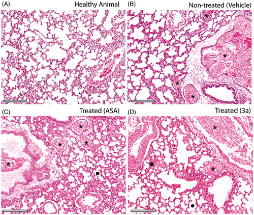 Figure 4. Histopathology of the lungs isolated from mice subjects included for in vivo pulmonary thromboembolism (HnE staining, 8× magnification; scale bar = 600 μm). Microscopic emboli (*) are seen for all treated groups. (A–D) Intense bronchoconstriction is seen for all treated groups with a slight integrity of alveoli (•) observed for the 3a-treated group, which also displays increased blood perfusion (▪). Only derivative 3a was used because the high survival rate was observed previously (D). All derivatives and ASA were assayed at 10 mM/kg (HnE staining, 8× magnification; scale bar = 600 μm).