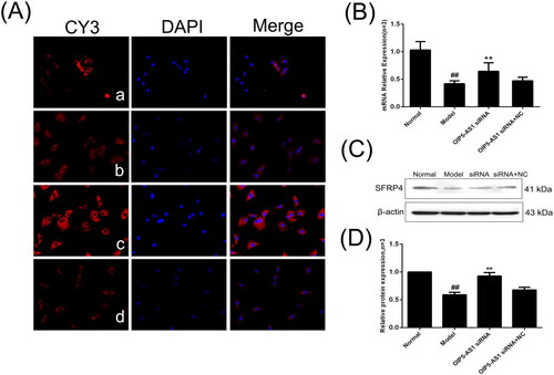 Figure 11. The changes of SFRP4 protein and mRNA expression in FLSs from AA rats after lncRNA OIP5-AS1 siRNA. (A) The change of SFRP4 protein expression was observed by immunofluorescence (×200; a: normal group; b: model group; c: lncRNA OIP5-AS1 siRNA group; and d: lncRNA OIP5-AS1 siRNA + NC group). (B) The change of SFRP4 mRNA expression was evaluated by qRT-PCR. (C) The change of SFRP4 protein expression was evaluated by Western blot analysis. (D) Semiquantitative analysis of SFRP4 protein. ##P<0.01 compared to the normal group; *P<0.05 and **P<0.01 compared to the model group. Normal: normal synovial cells; Model: FLSs from AA rats; OIP5-AS1 siRNA: lncRNA OIP5-AS1 siRNA2; OIP5-AS1 siRNA + NC: negative control for siRNA.