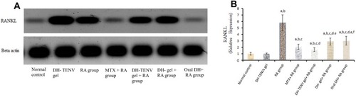 Figure 6 Effect of transdermal application of DH- TENV gel on RANKL relative expression as compared to arthritic group using Western blot analysis. Each value represents the mean of 8 experimental rat ± SEM. Statistical analysis was performed using one-way ANOVA followed by Tukey-Kramer post- multiple comparisons test. aSignificantly different from normal control group at p < 0.05. bSignificantly different from DH -TENV gel group at P < 0.05. cSignificantly different from RA group at P < 0.05. dSignificantly different from MTX+ RA group at P < 0.05. eSignificantly different from DH-TENV gel+ RA group at P < 0.05. fSignificantly different from oral DH+ RAgroup at P < 0.05.Abbreviations: ANOVA, analysis of variance; RA, Rheumatoid Arthritis; MTX, Methotrexate; DH, dapoxetine HCl; TENV, transethosome nanovesicle; RANKL, Receptor activator of nuclear factor kappa-Β ligand; B-Actin, Beta-Actin.